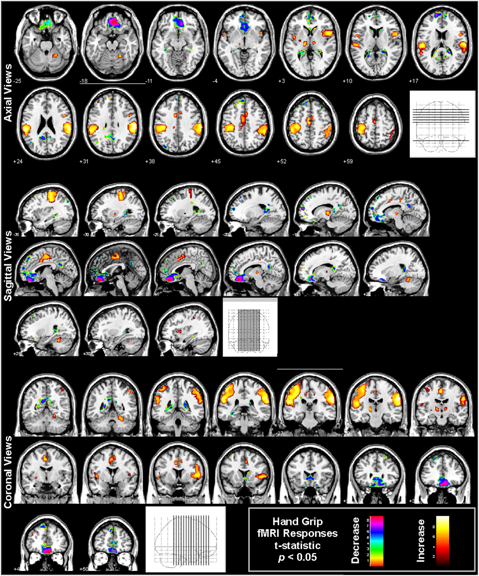 Frontiers Functional Imaging Of Autonomic Regulation Methods And Key Findings Neuroscience