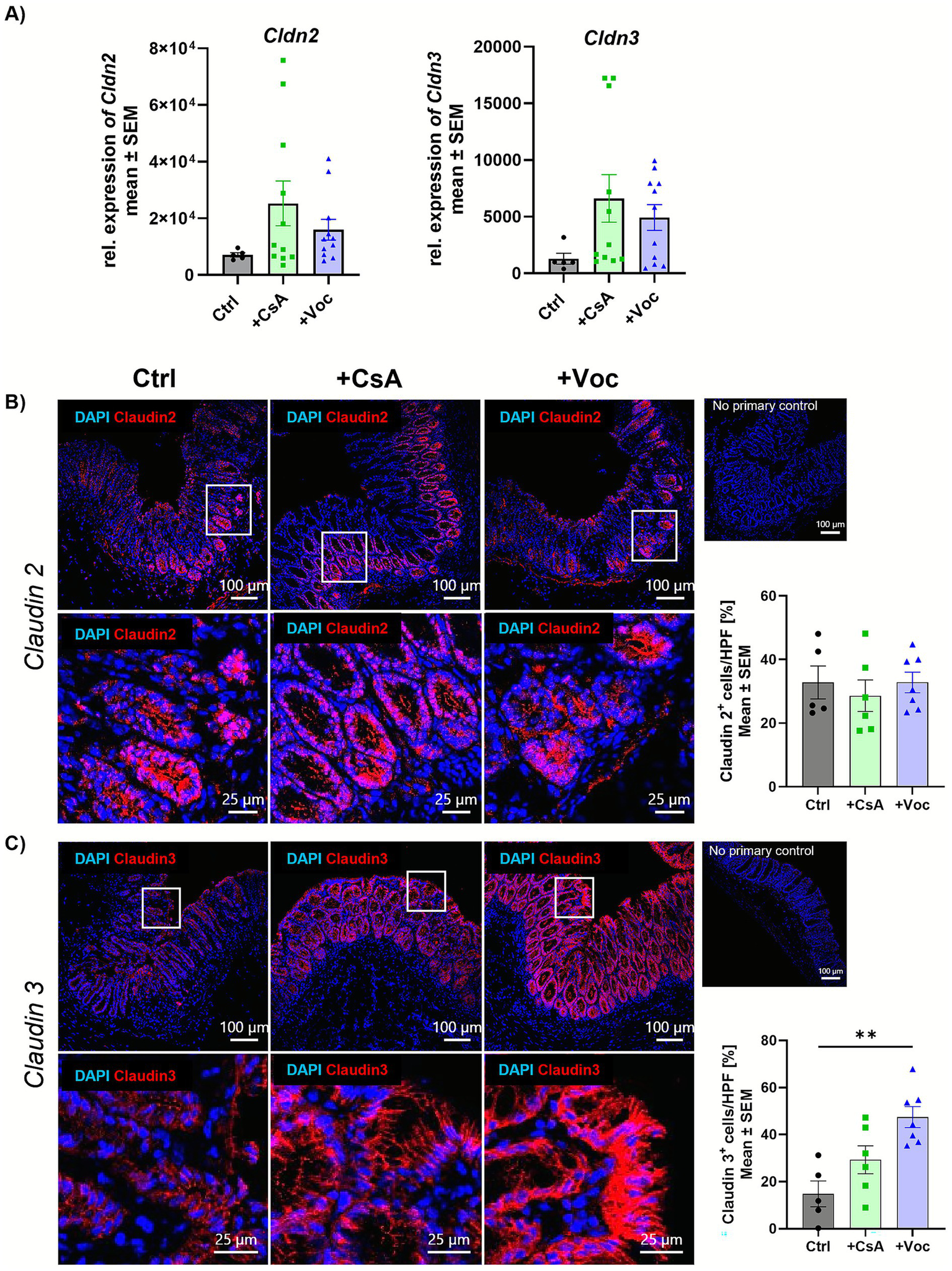 Graphs and microscopy images show expression levels and localization of claudin proteins. Panel A displays bar graphs comparing relative expression of Cldn2 and Cldn3 across control, CsA, and Voc-treated samples. Panels B and C contain fluorescence microscopy images of tissues stained for Claudin 2 and Claudin 3, respectively, showing cell membrane localization. Quantification graphs for claudin-positive cells are included, showing increased expression with treatment. Scale bars indicate magnification levels.