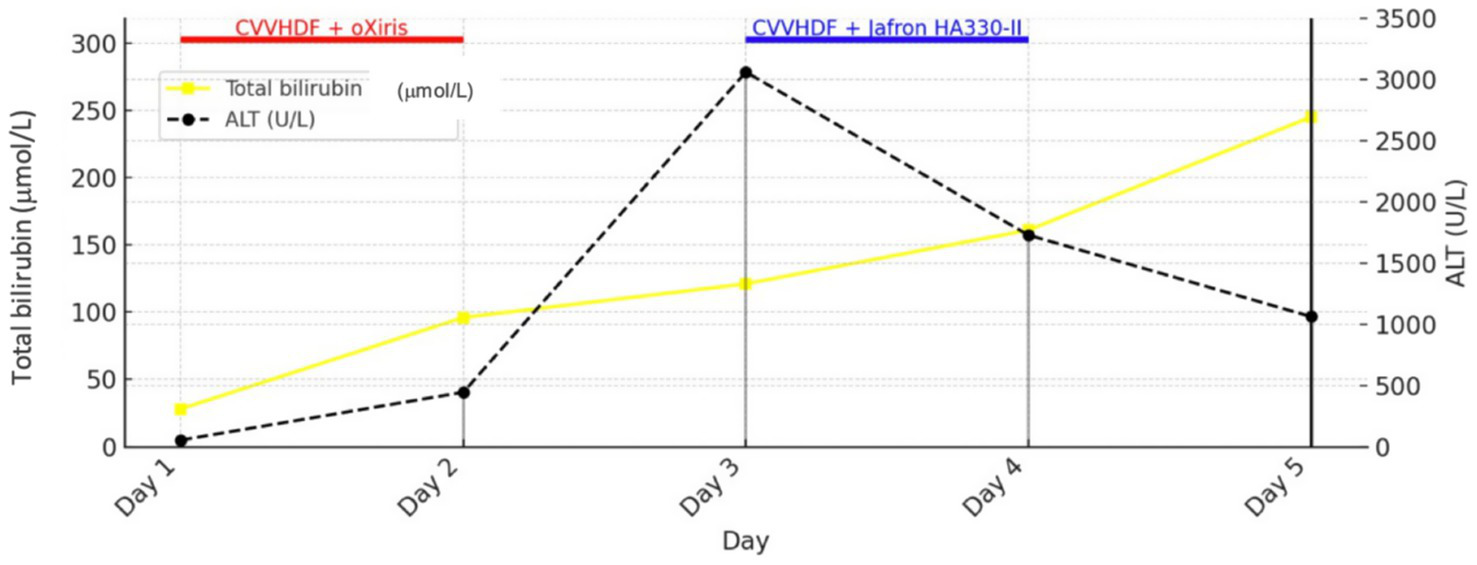 Line chart showing changes in total bilirubin and ALT levels over five days. Total bilirubin, in yellow, rises sharply from 50 µmol/L to 300 µmol/L. ALT, in black, increases from 0 U/L to around 3,200 U/L after peaking on day three. The chart includes CVVHDF with oXiris and Jafron HA330-II treatments highlighted in red and blue bars, respectively.