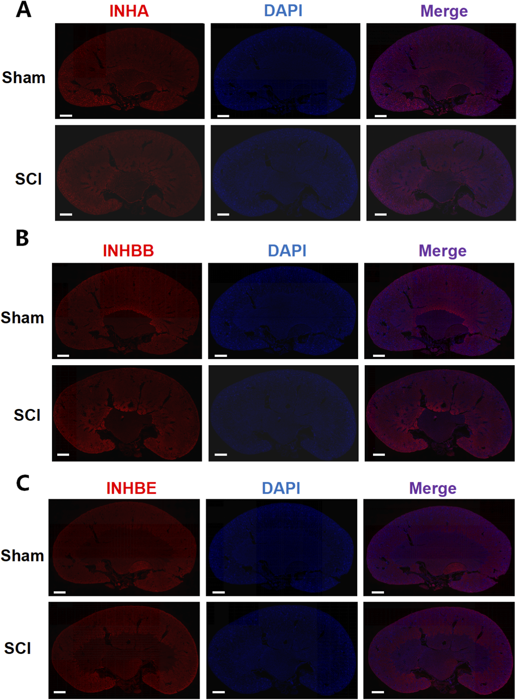 Panel A, B, and C show fluorescence images of spinal cord sections from Sham and SCI (spinal cord injury) groups, each labeled for red INHA (A), INHBB (B), or INHBE (C), blue DAPI for nuclei, and merged overlays.