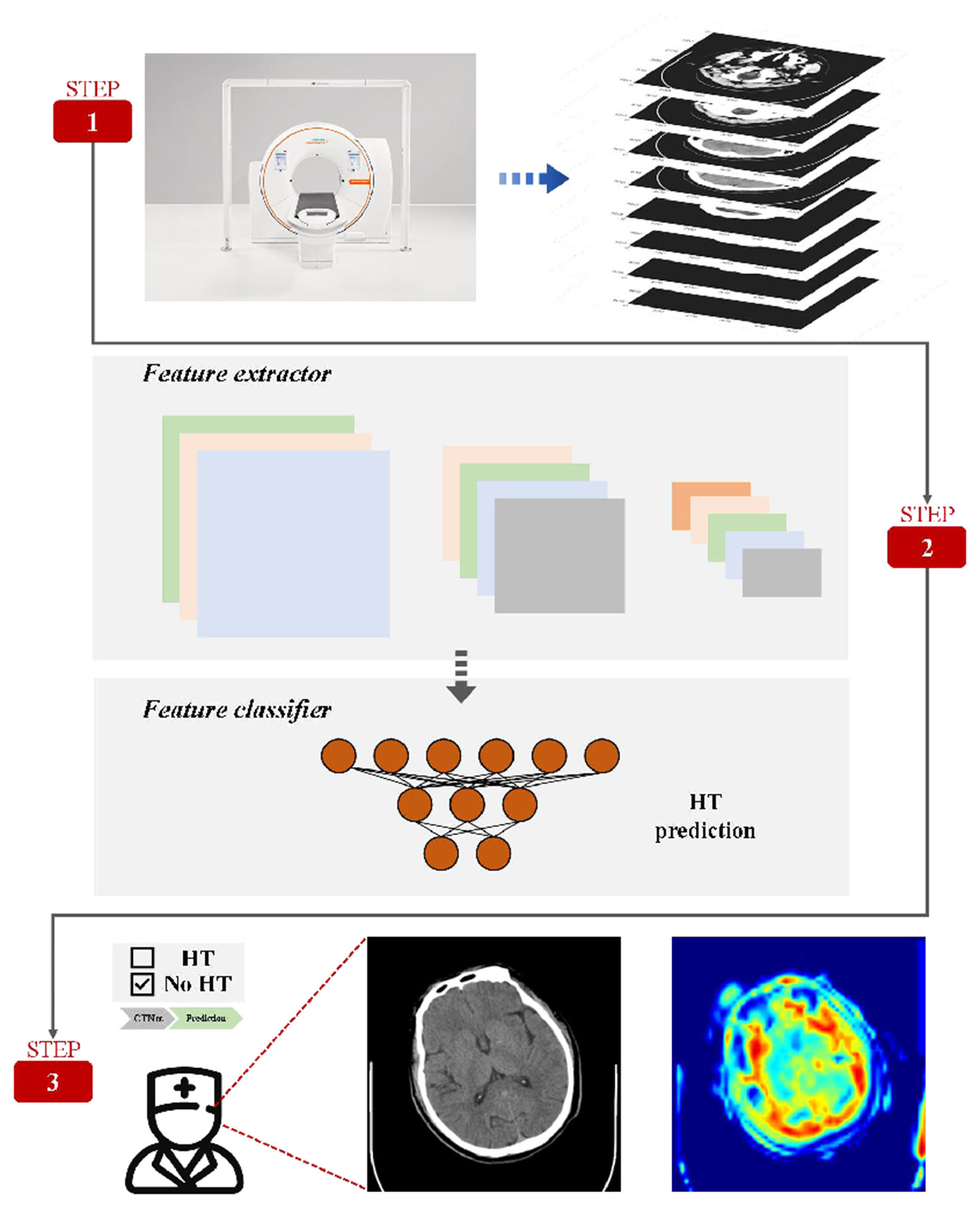 Diagram showing a three-step process for medical imaging analysis. Step 1 features a CT scanner and image slices. Step 2 involves a feature extractor and classifier for HT prediction. Step 3 includes a medical professional, a checklist with “No HT” checked, and two brain images displaying CT and processed data.