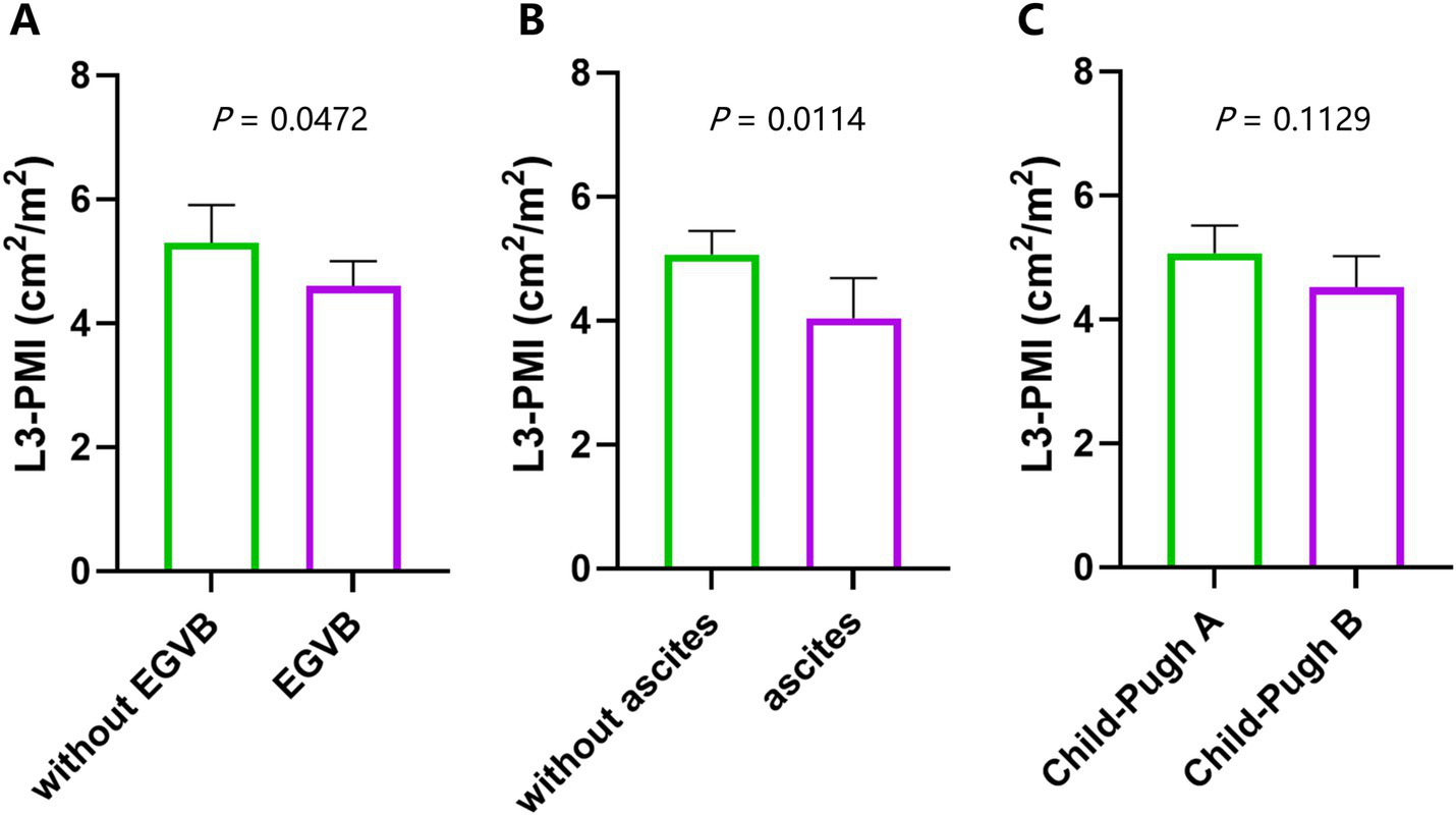 Bar graphs A, B, and C compare L3-PMI values (in square centimeters per square meter) for different conditions. Graph A shows higher values without EGVB compared to EGVB with P = 0.0472. Graph B shows higher values without ascites compared to with ascites with P = 0.0114. Graph C shows similar values between Child-Pugh A and Child-Pugh B with P = 0.1129.