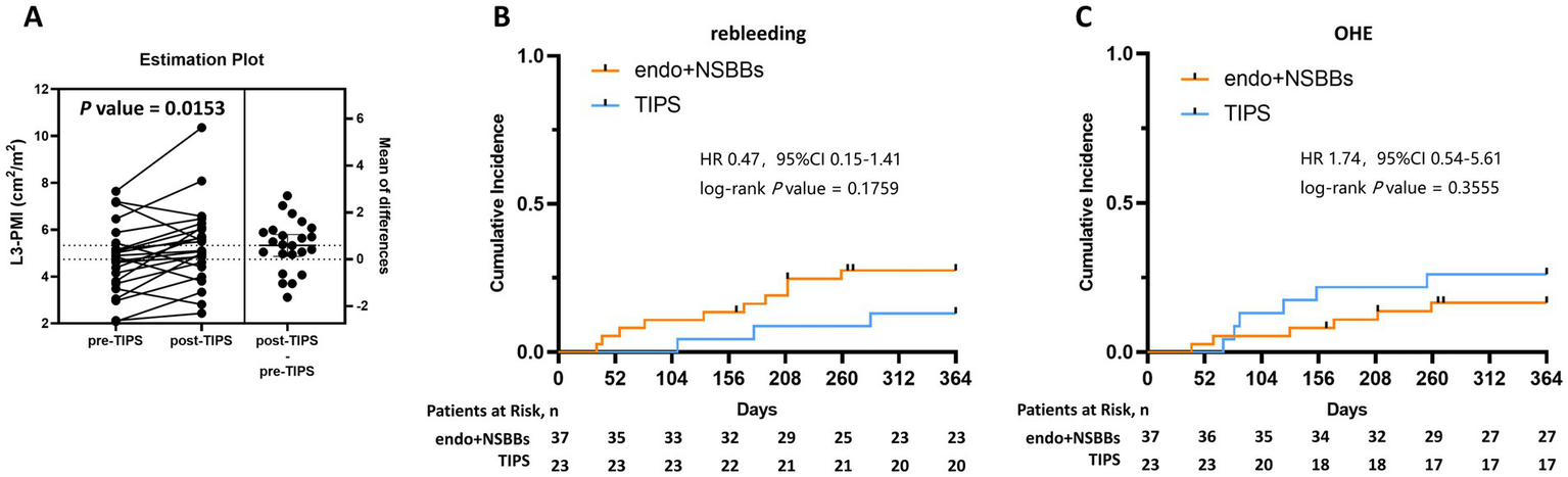 Panel A shows an estimation plot comparing L3-PMI values pre and post-TIPS, with a p-value of 0.0153 indicating significance. Panel B is a cumulative incidence graph of rebleeding over time for endo+NSBBs versus TIPS, with a hazard ratio of 0.47. Panel C shows cumulative incidence of OHE, with a hazard ratio of 1.74, both including patients at risk over 364 days.