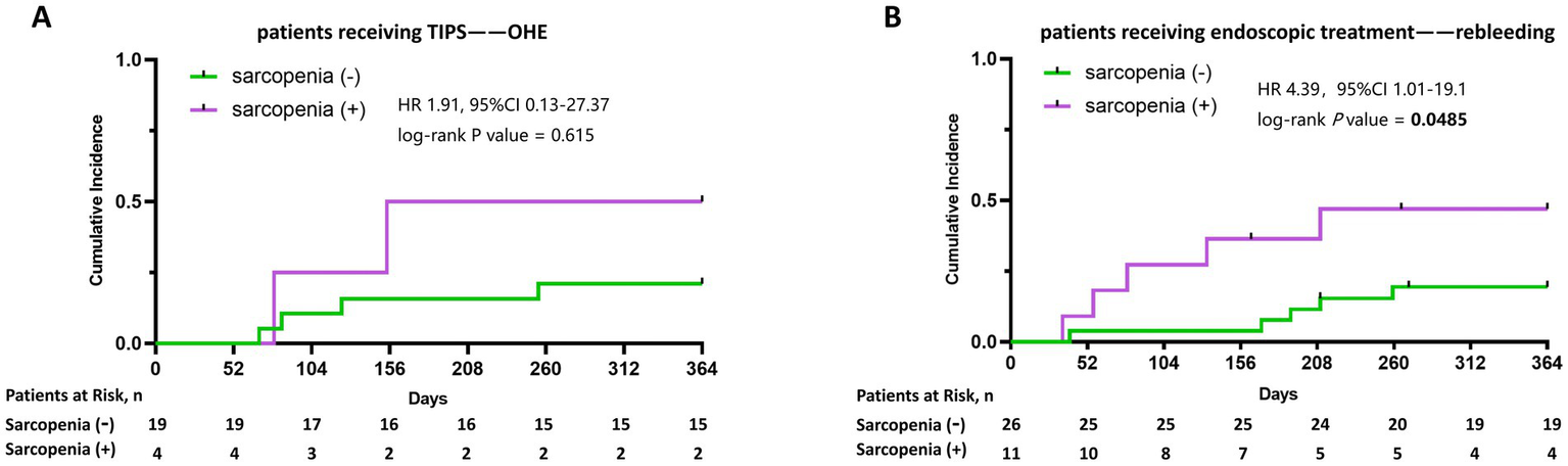 Two line graphs compare cumulative incidence over 364 days. Graph A (left) shows patients with TIPS and OHE, with a log-rank P value of 0.615, indicating no significant difference between those with and without sarcopenia. Graph B (right) shows patients receiving endoscopic treatment for rebleeding, with a log-rank P value of 0.0485, suggesting a significant difference. Sarcopenia status is indicated by green (negative) and purple (positive) lines, with patient numbers decreasing over time.