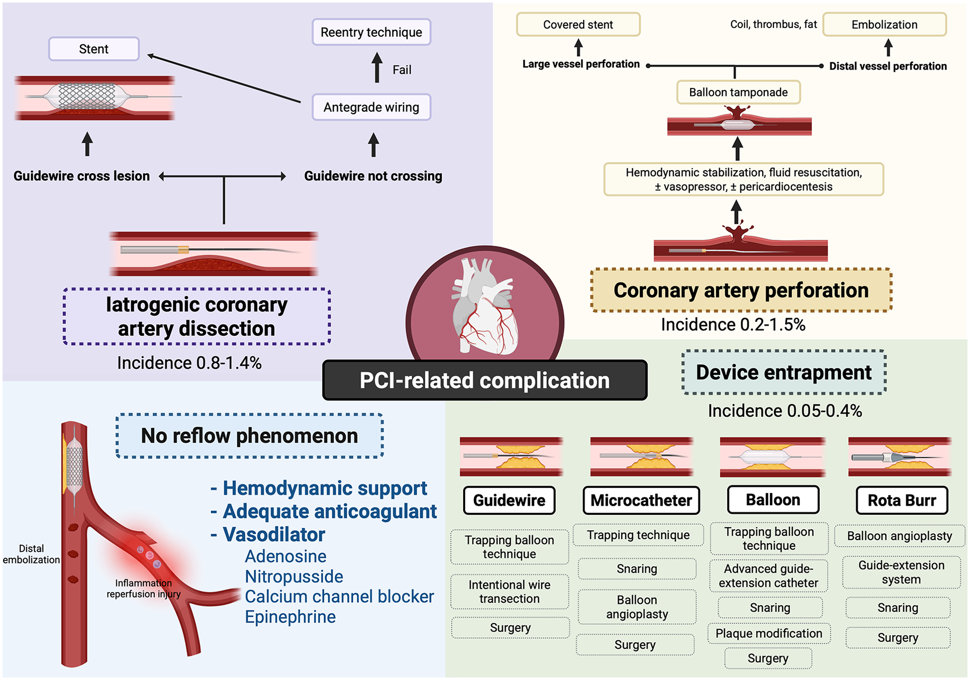 Diagram of PCI-related complications with four sections: iatrogenic coronary artery dissection, coronary artery perforation, no reflow phenomenon, and device entrapment. Each section lists causes, methods, and incidences. Includes elements like stents, guidewires, and hemodynamic support strategies. A central heart illustration connects the sections.