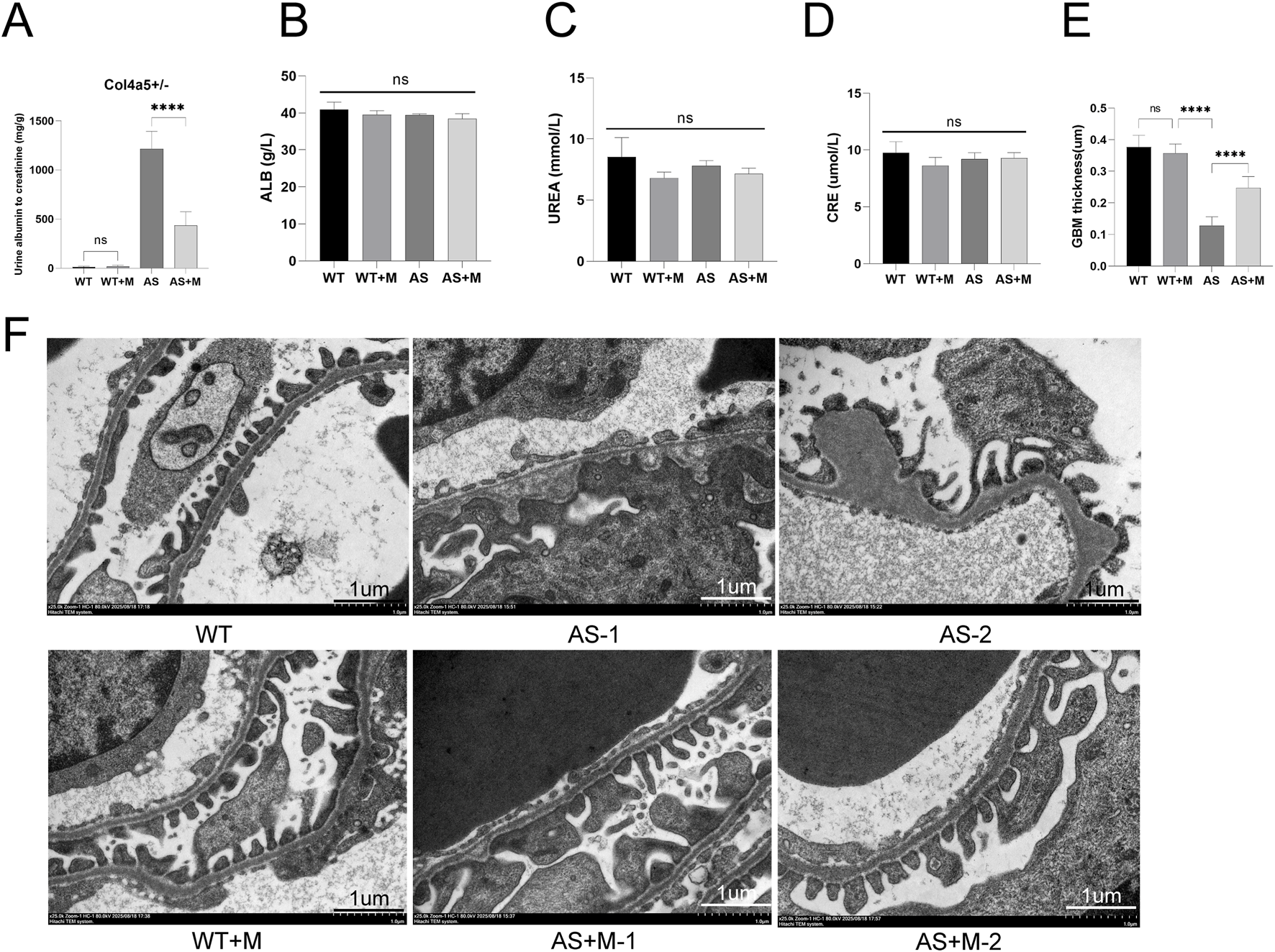 Figure includes five bar charts labeled A-E comparing urinary albumin, blood albumin, urea, creatinine, and glomerular basement membrane thickness across four groups (WT, WT+M, AS, AS+M). Significant increases are observed in albuminuria and membrane thickness in AS compared to controls, with treatments reducing these effects. Panel F contains six transmission electron microscopy images of glomerular ultrastructure for each group, showing differences in basement membrane thickness and podocyte morphology. Scale bars indicate one micrometer.