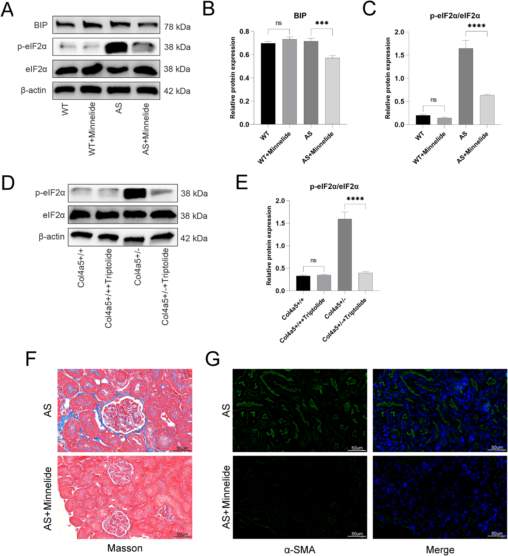 Panel A shows western blot bands for BIP, phosphorylated eIF2α, total eIF2α, and β-actin in WT, WT+Minnelide, AS, and AS+Minnelide groups. Panel B is a bar graph quantifying BIP levels, Panel C quantifies p-eIF2α/eIF2α ratio, both showing significant changes, particularly increased p-eIF2α/eIF2α in AS. Panel D shows western blot bands for p-eIF2α, eIF2α, and β-actin in Col4a5+/+ and Col4a5+/− with Triptolide groups. Panel E is a bar graph quantifying p-eIF2α/eIF2α ratios, with a significant decrease in the Triptolide-treated group. Panel F presents two Masson-stained kidney tissue sections from AS and AS+Minnelide groups, with reduced blue-staining fibrosis in the treated group. Panel G displays immunofluorescence images of kidney sections stained for α-SMA (green) and merged with DAPI (blue), showing reduced α-SMA signal in AS+Minnelide compared to AS, suggesting decreased fibrosis.