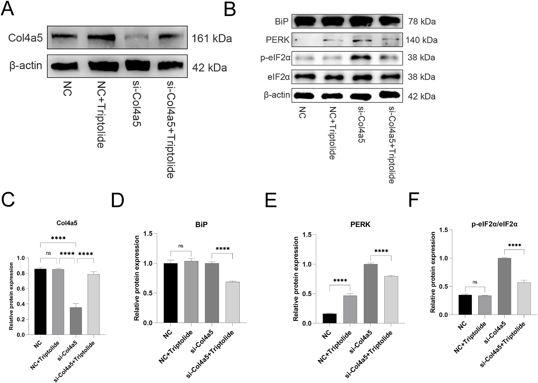 Western blot panels labeled A and B show protein bands for Col4a5, β-actin, BiP, PERK, p-eIF2α, and eIF2α under conditions NC, NC plus Triptolide, si-Col4a5, and si-Col4a5 plus Triptolide, with molecular weights indicated. Bar graphs C, D, E, and F display quantified relative protein expression for Col4a5, BiP, PERK, and p-eIF2α/eIF2α, respectively, with statistical significance denoted by asterisks and "ns" for not significant, comparing the four conditions.