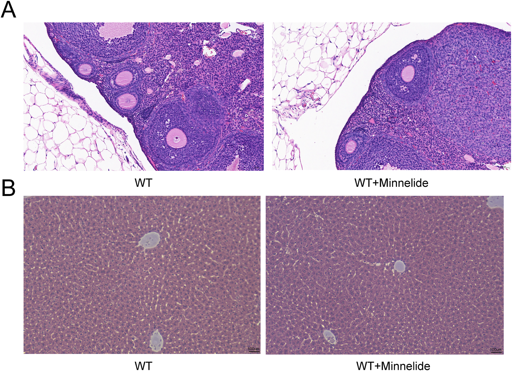 Panel A shows two histological sections of ovarian tissue, with the left labeled WT and the right labeled WT plus Minnelide, both displaying follicular structures. Panel B shows two histological sections of liver tissue, with the left labeled WT and the right labeled WT plus Minnelide, each presenting normal-appearing hepatic organization.