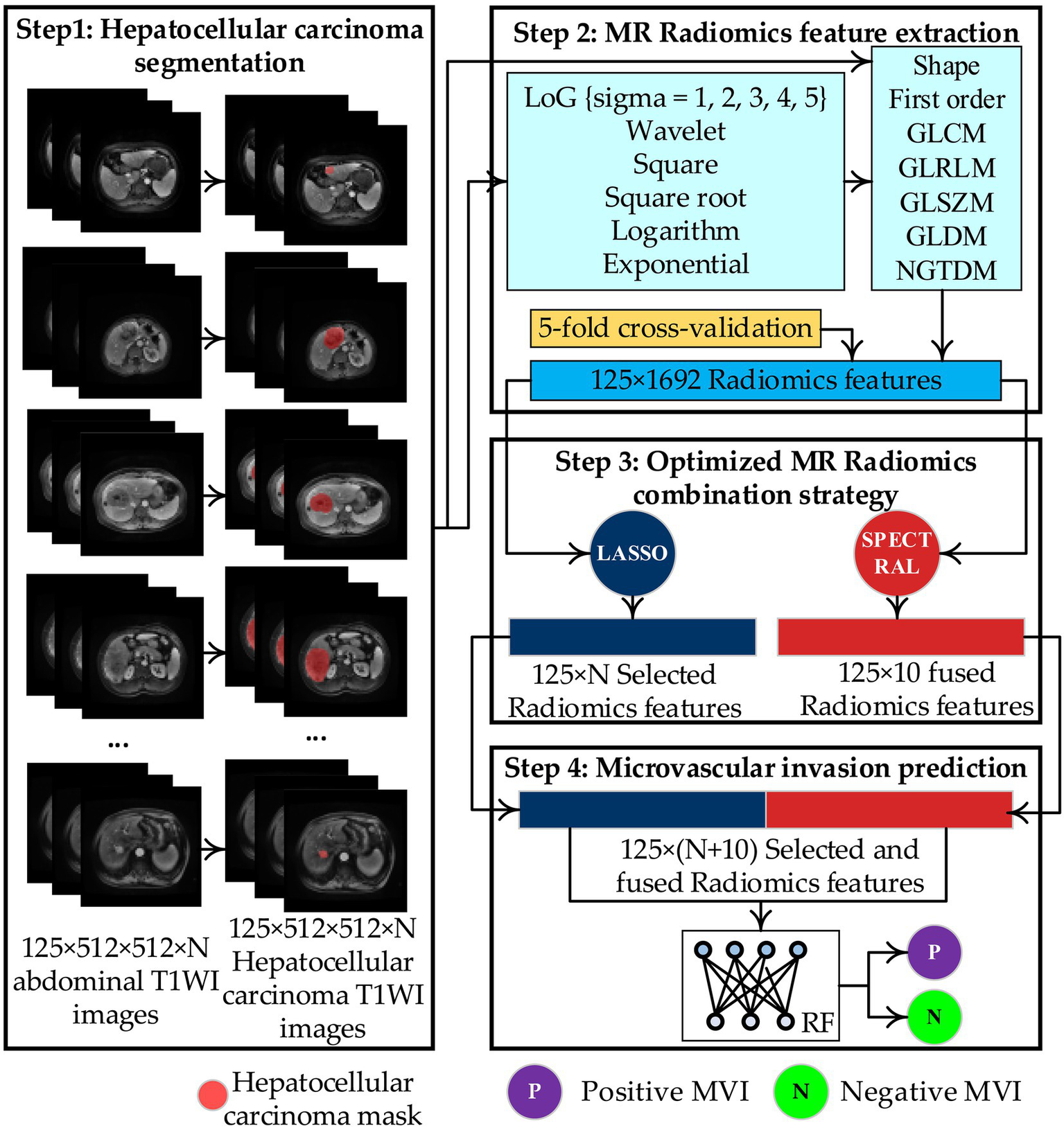 Flowchart illustrating a four-step pipeline for predicting microvascular invasion (MVI) in hepatocellular carcinoma from abdominal MR images. The steps shown are tumor segmentation, MR radiomics feature extraction, radiomics combination and optimization using LASSO and SPECTRAL, and final MVI prediction using a random forest predictor, with outcomes labeled as positive or negative MVI.