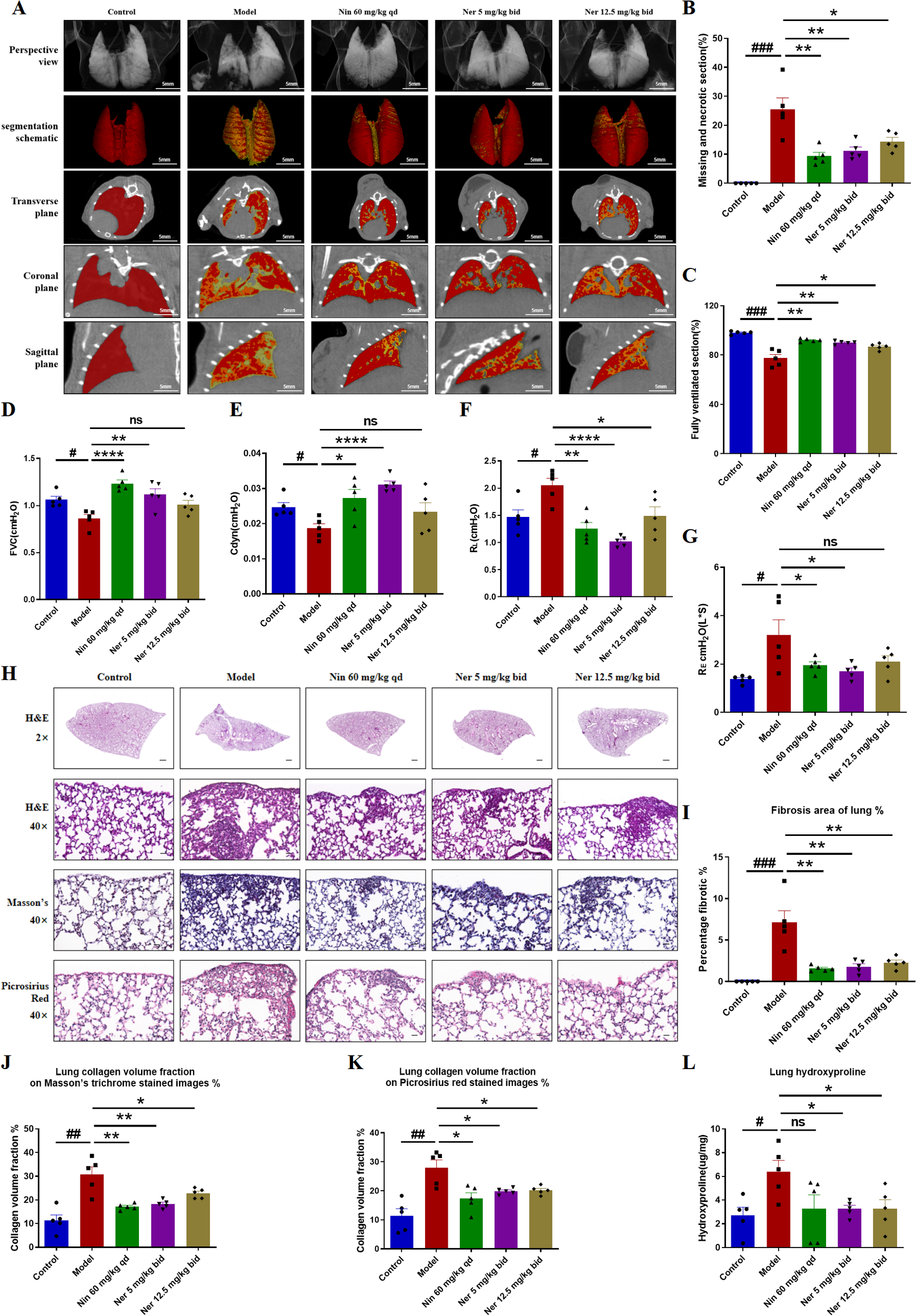 Panel A displays CT images and lung segmentation schematics across five groups, showing differences in lung structure. Panels B-G present bar graphs comparing quantitative measurements of CT and lung function across the groups. Panel H features representative histological images of lung tissue stained with H&E, Masson's trichrome, and Picrosirius Red at various magnifications for each group. Panels I-L include bar graphs measuring fibrosis area, collagen volume fraction, and hydroxyproline content among the groups, illustrating statistical differences marked by asterisks and hash symbols.