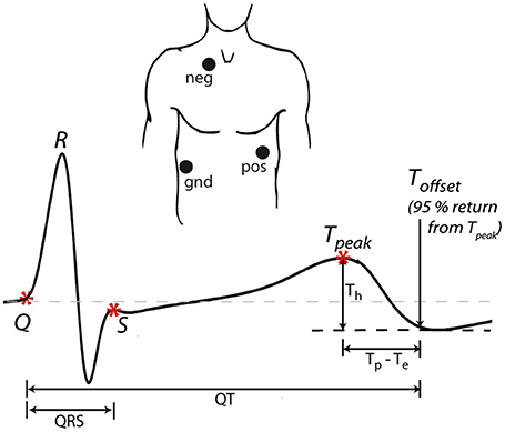 Frontiers | Heritability of ECG Biomarkers in the Netherlands Twin ...