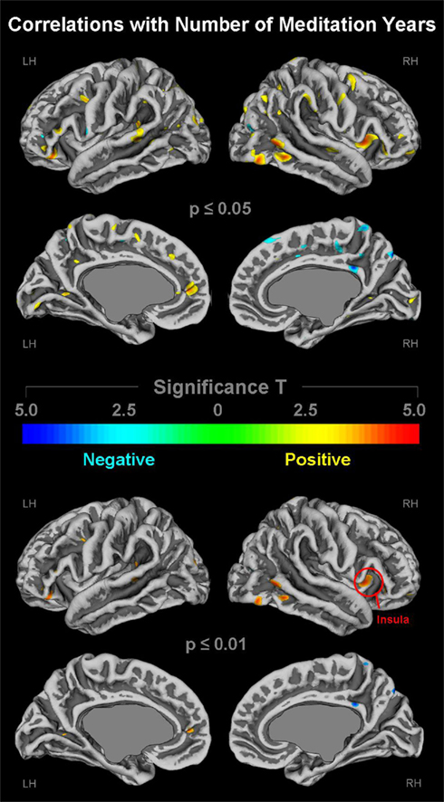 Impacts of Meditation on Brain