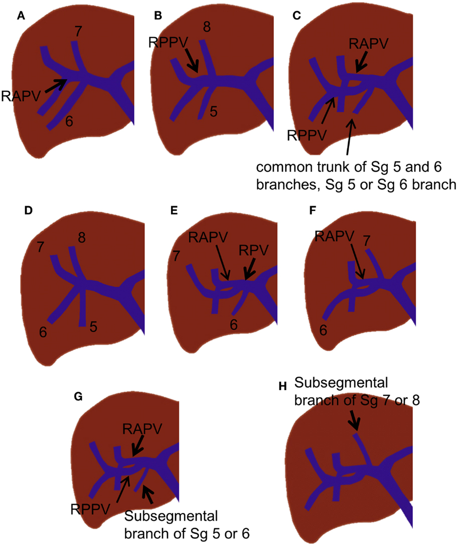 Portal Vein A Vein Carrying Blood From The Digestive Organs And