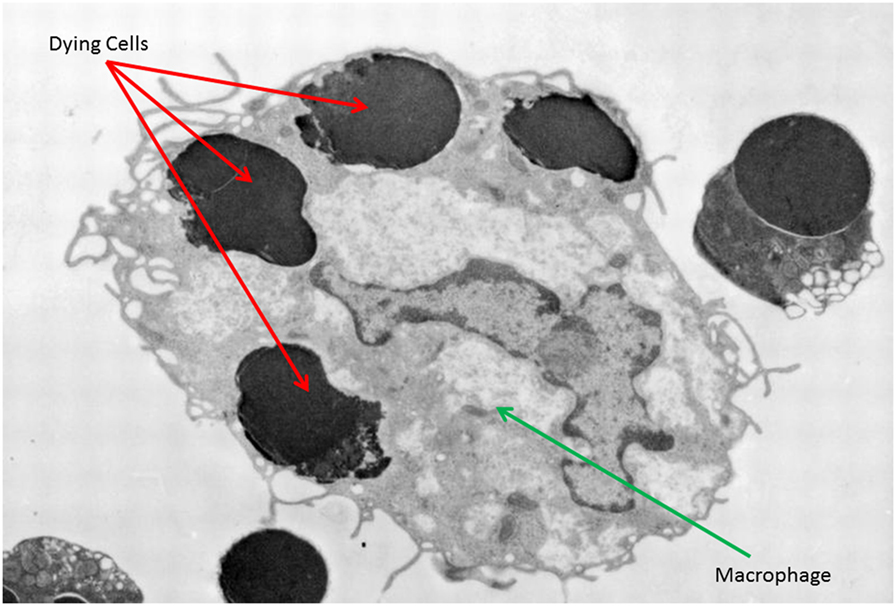 איור 2 - תמונה של מיקרוסקופ אלקטרונים המראה מקרופאג’ מבצע פאגוציטוזה של ארבעה תאים מתים (כתמים שחורים בתוך המקרופאג’) [2].