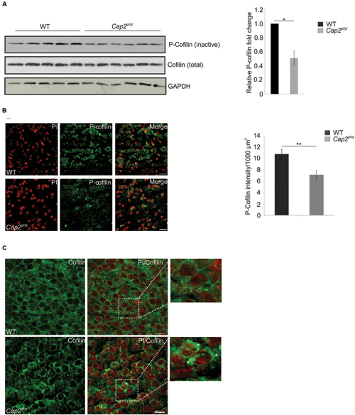 Frontiers | Neuronal Actin Dynamics, Spine Density and Neuronal
