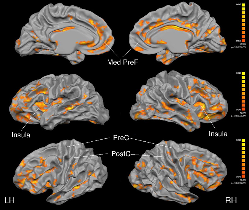 lodret Pakistan forhold Frontiers | Impact of Long-Term Endurance Training vs. Guideline-Based  Physical Activity on Brain Structure in Healthy Aging | Aging Neuroscience