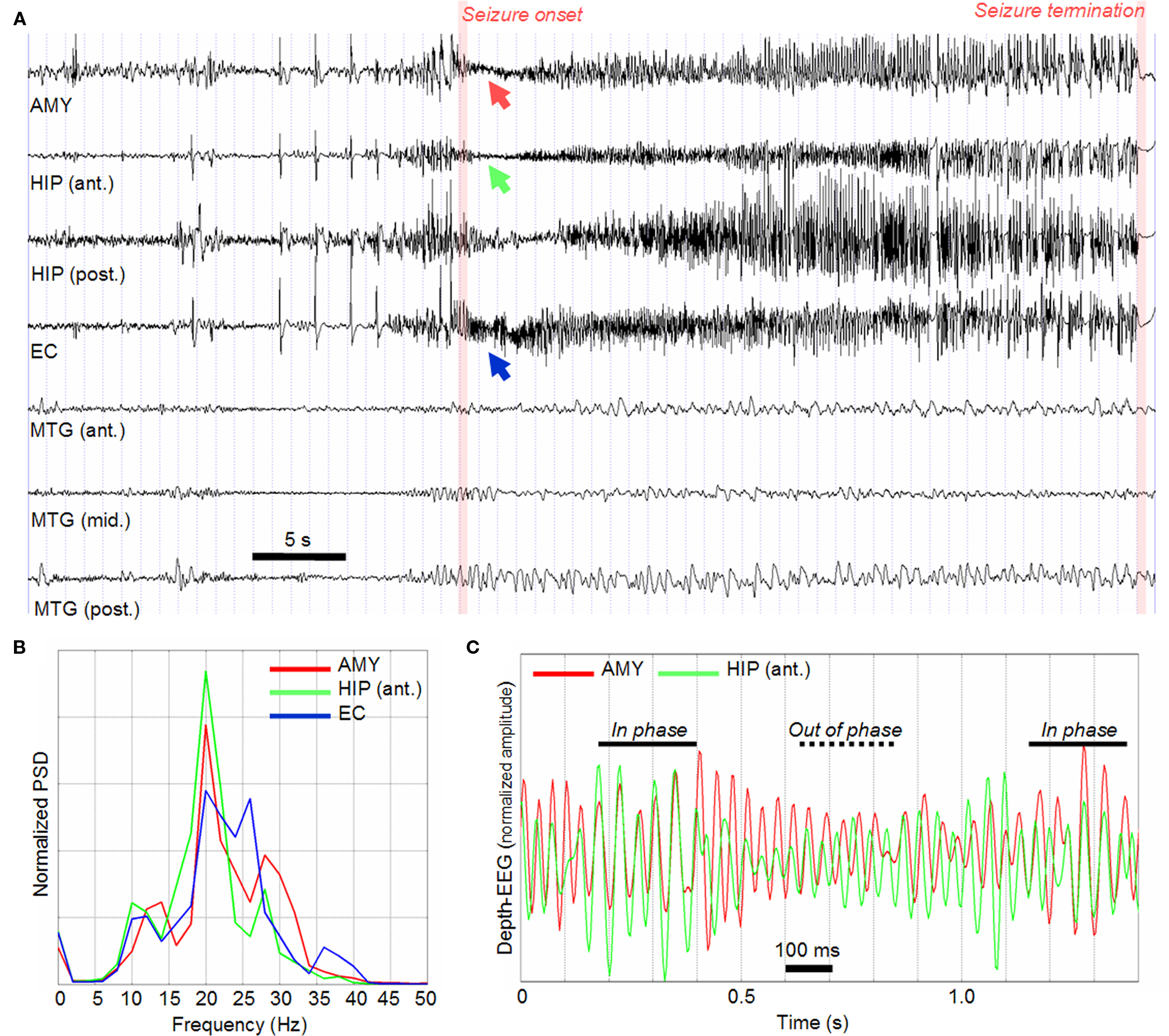 Communication on this topic: Recording Epilepsy Seizures, recording-epilepsy-seizures/ Discussion on this topic: Recording Epilepsy Seizures, recording-epilepsy-seizures/
