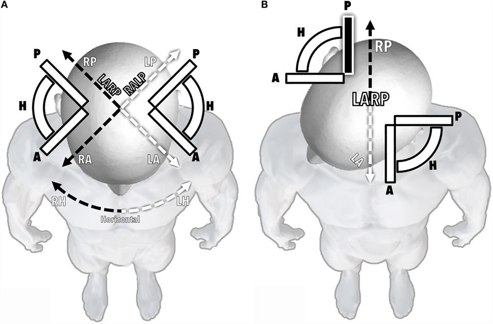 hallpike maneuver illustration