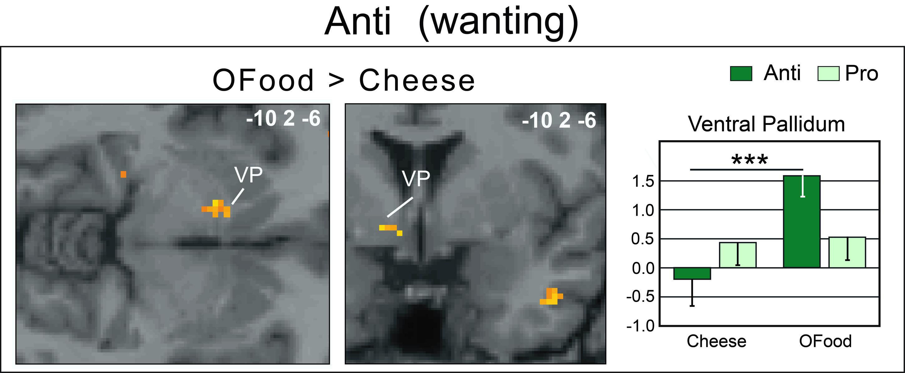 Frontiers The Neural Bases Of Disgust For Cheese An Fmri Study Human Neuroscience