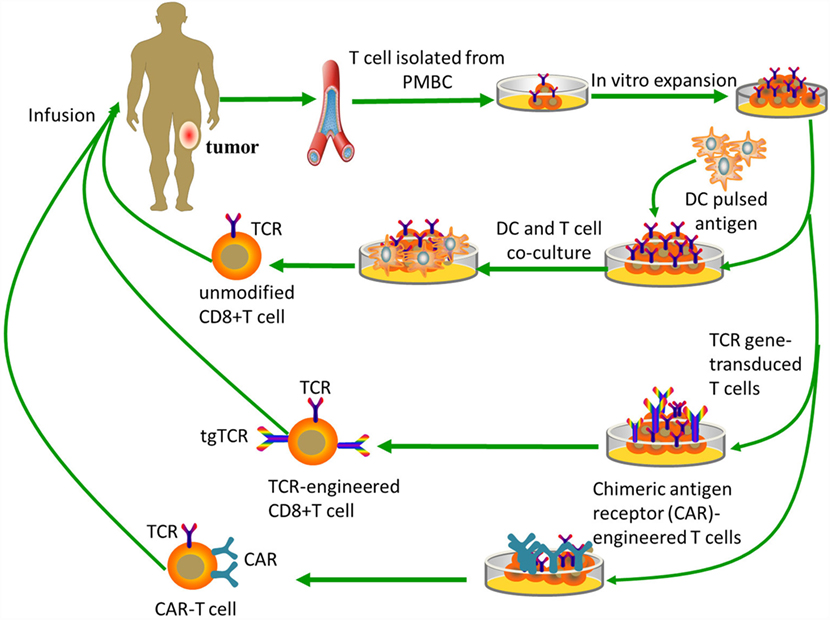 does bone cancer metastasis to the brain