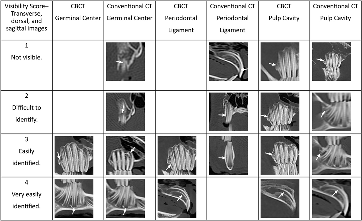 Cbct Comparison Chart