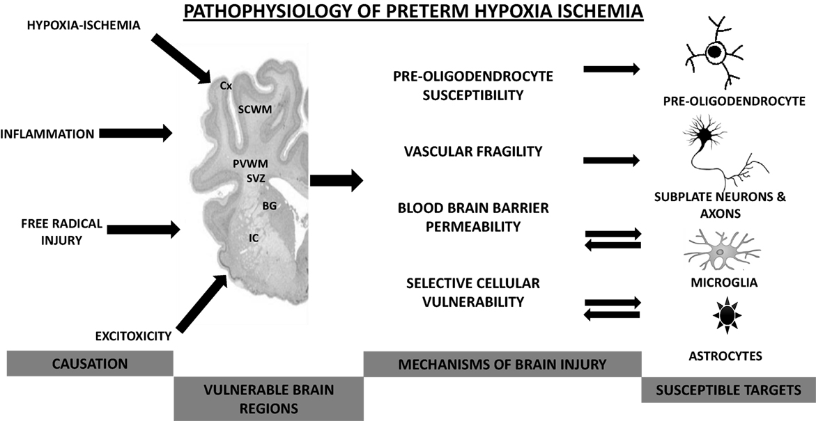 Hypoxic Ischemic Encephalopathy Pathophysiology