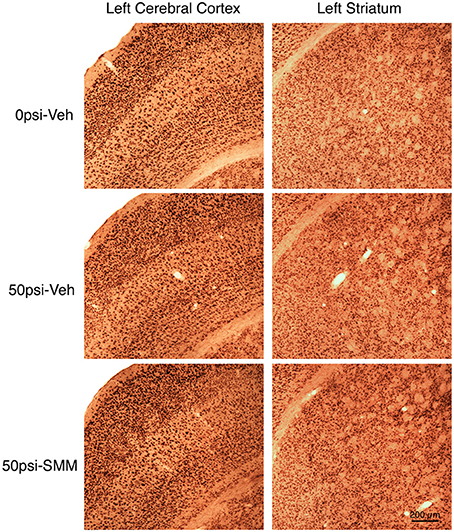 Frontiers | Mild Traumatic Brain Injury Produces Neuron Loss That Can ...