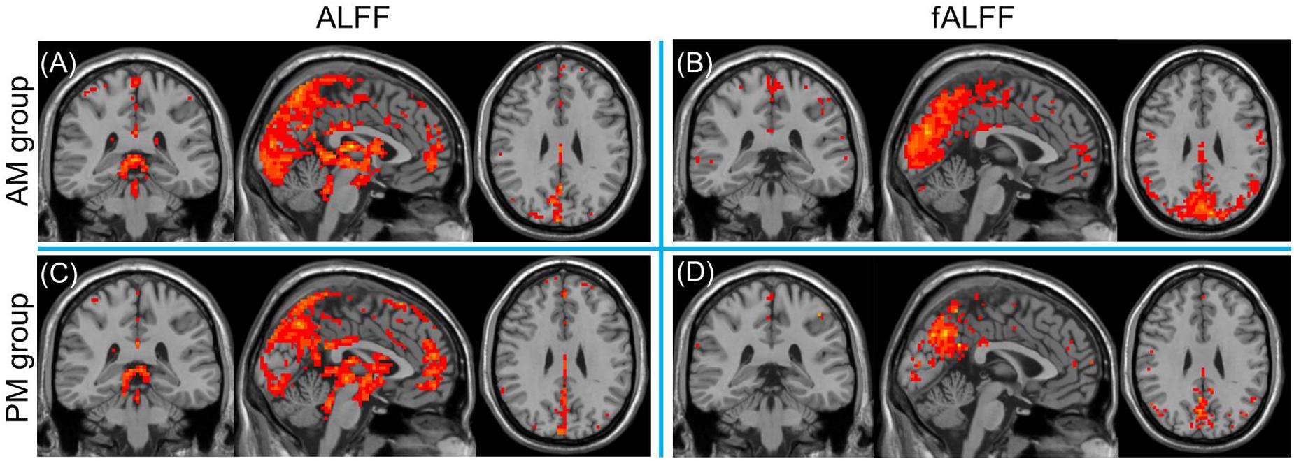 Frontiers Diurnal Variations in Neural Activity of Healthy Human
