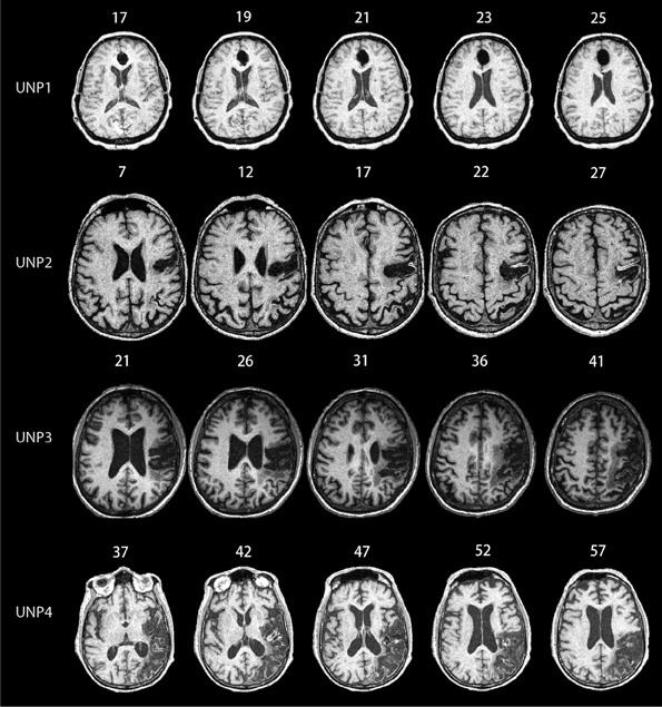 Frontiers | Extracting the mean size across the visual field in ...