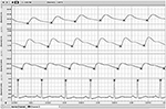 labchart reader unable to read file for an unknown reason