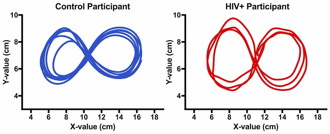 Frontiers  Impairments of Motor Function While Multitasking in HIV