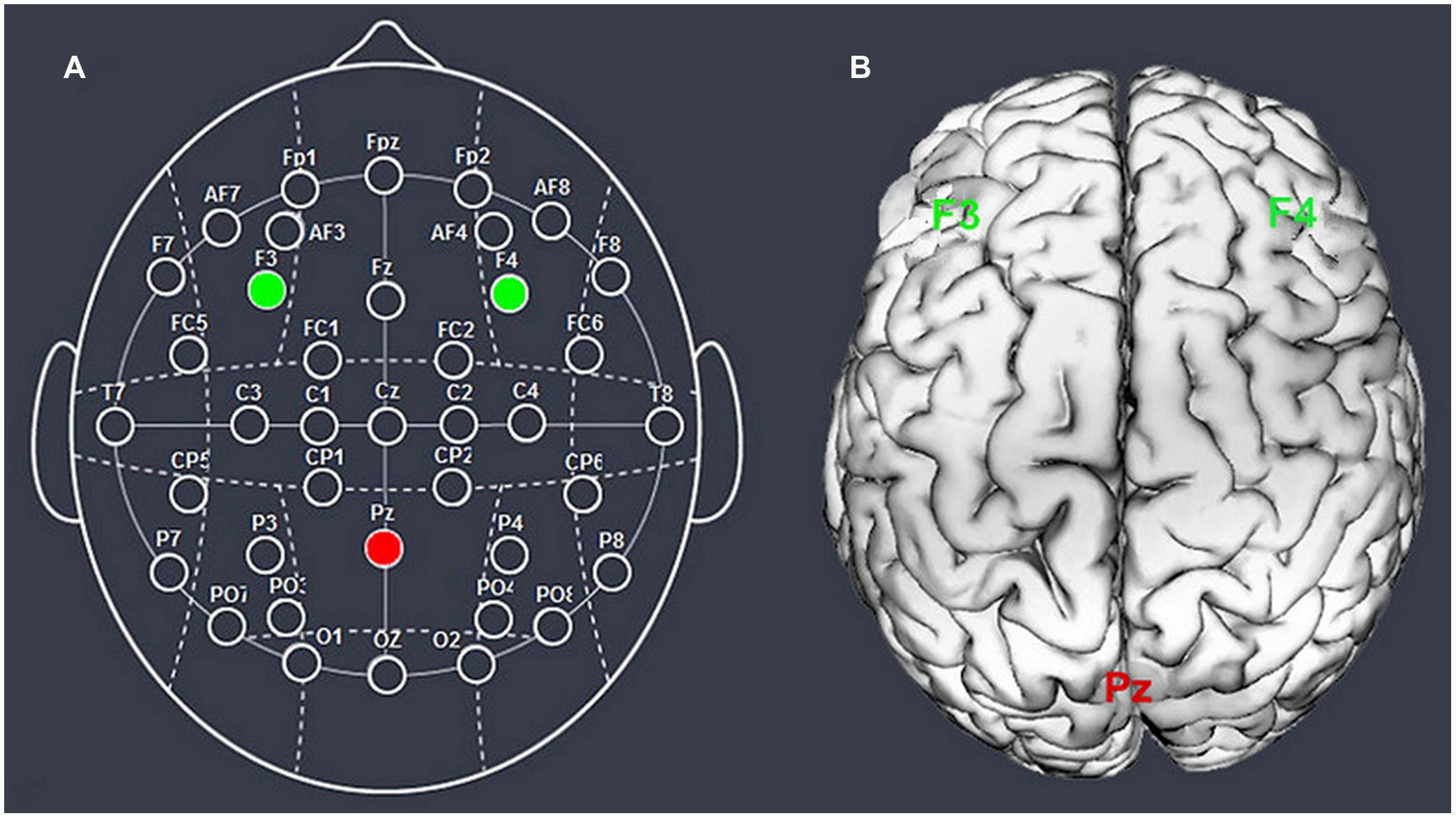 dorsolateral prefrontal cortex tdcs