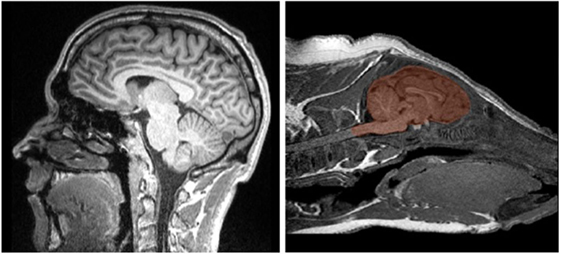 איור 1 - תמונת MRI של מוח אדם (משמאל) ושל מוח חזרזיר (בצבע חום, מימין).