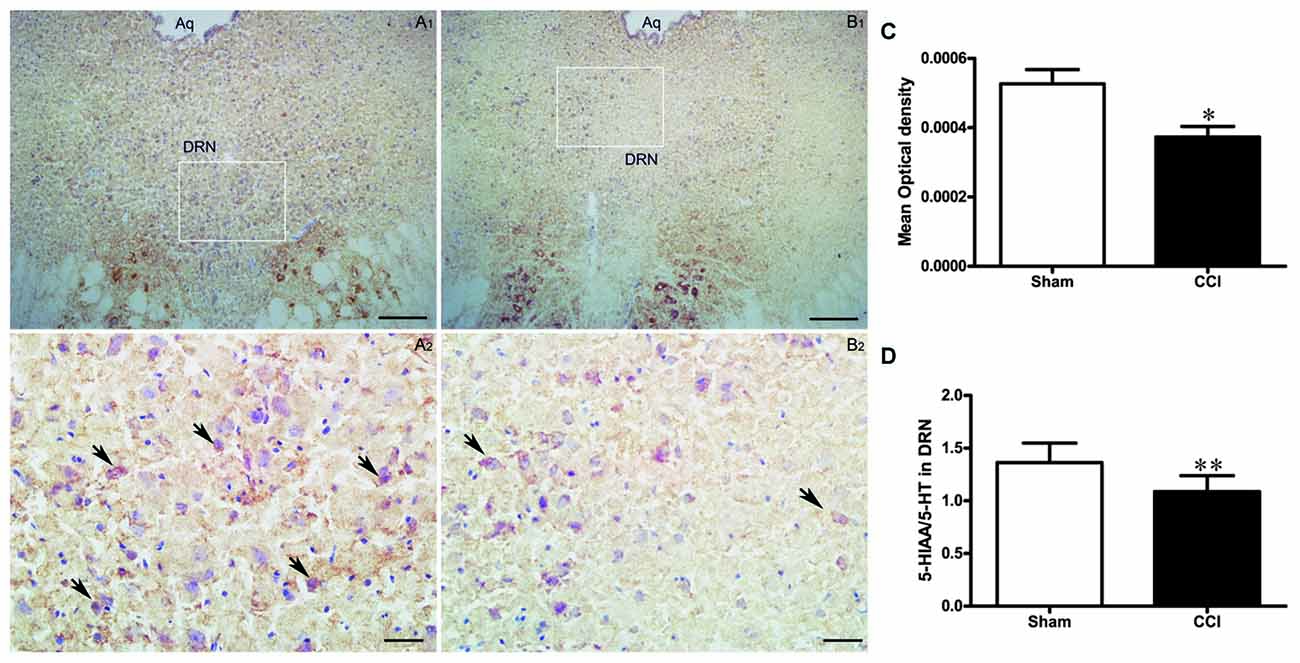 Frontiers | Role of the Lateral Habenula in Pain-Associated