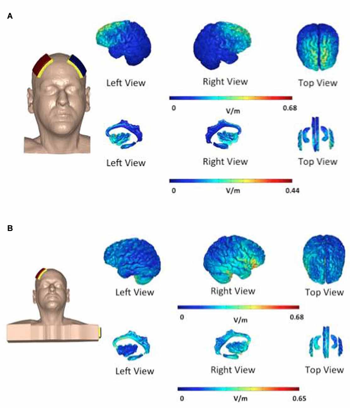 Tdcs Placement Chart