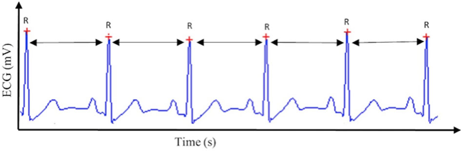 Ups Frastøde kontrol Frontiers | Heart Rate Variability and Cardiac Vagal Tone in  Psychophysiological Research – Recommendations for Experiment Planning,  Data Analysis, and Data Reporting