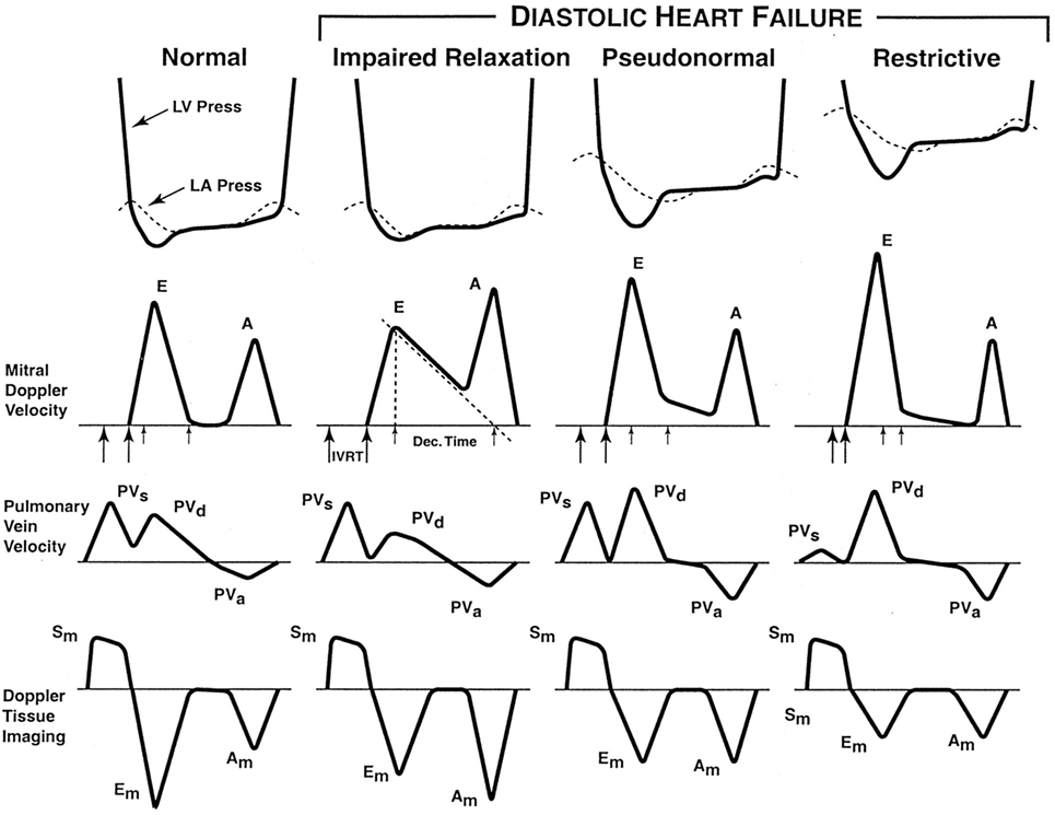 Frontiers | Assessment of Diastolic Function in Congenital Heart Disease | Cardiovascular Medicine