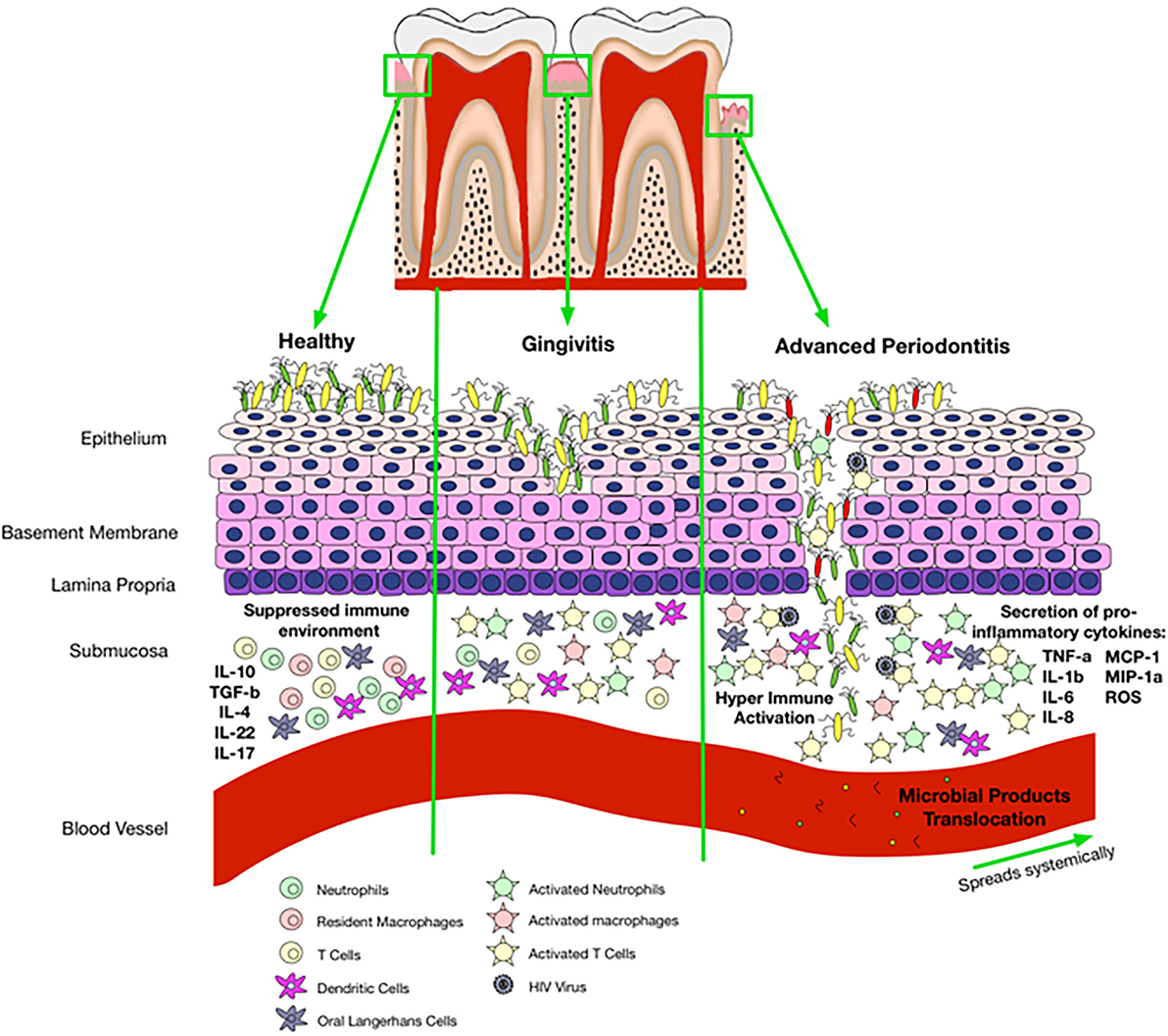 Polyamine metabolism impacts T cell dysfunction in the oral mucosa of people living with HIV