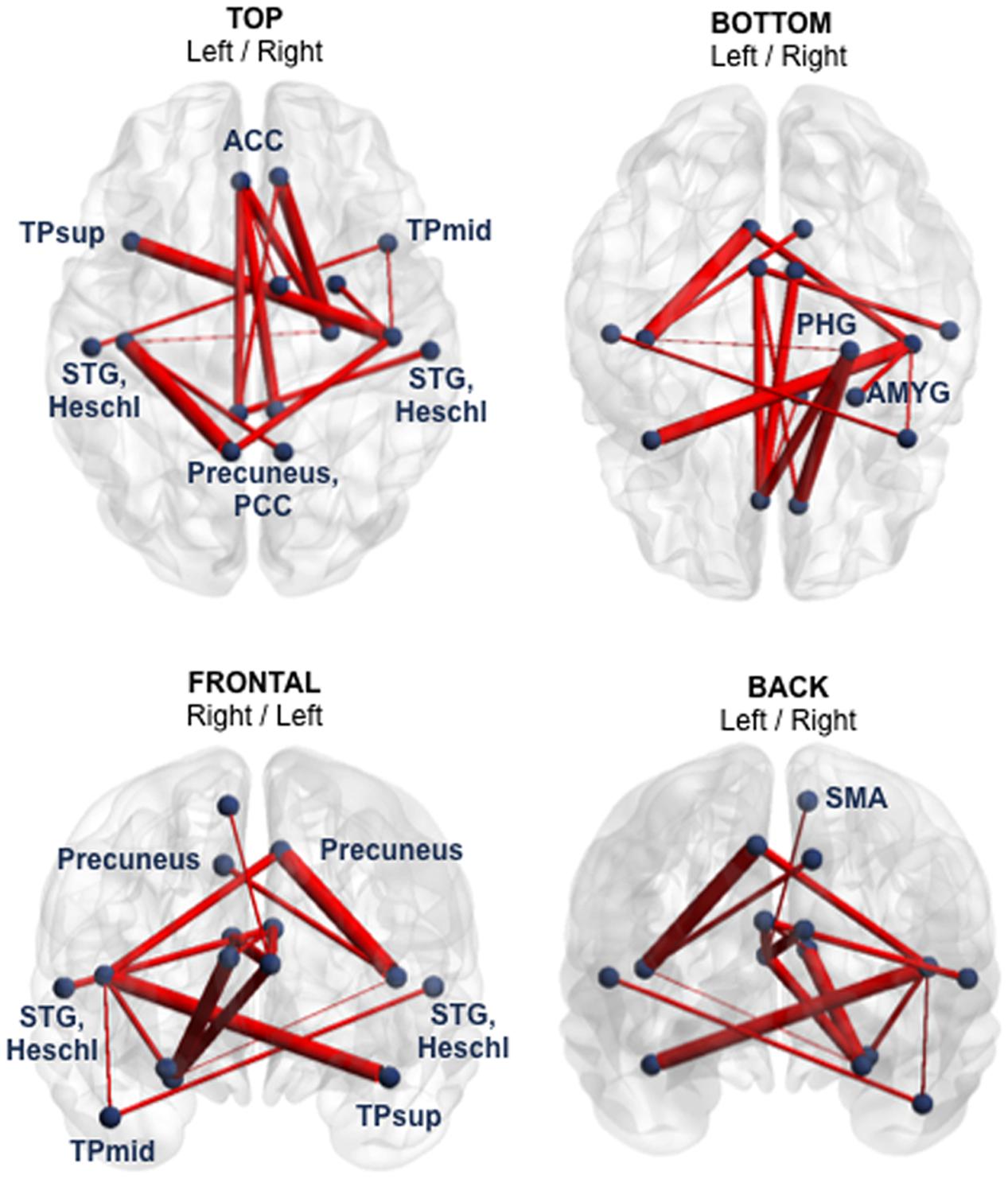 Long-term Multidomain Patterns of Change After Traumatic Brain Injury