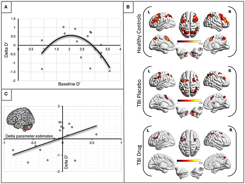 Semantic memory deficits are associated with pica in individuals with  acquired brain injury - ScienceDirect