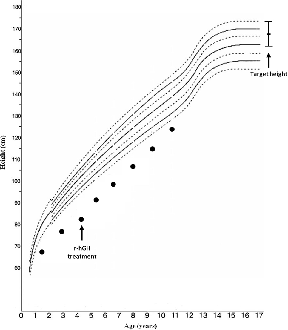 Igf 1 Level Chart