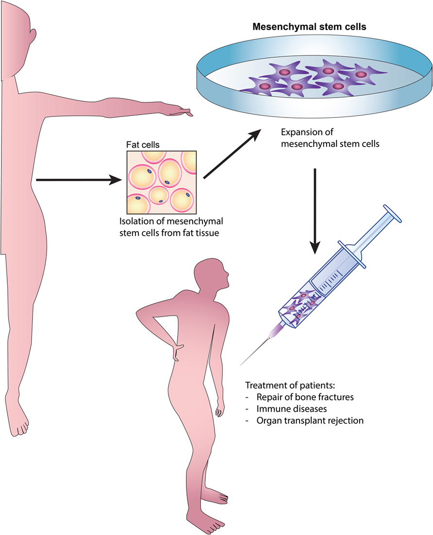 Denver Regenerative Medicine Treatment