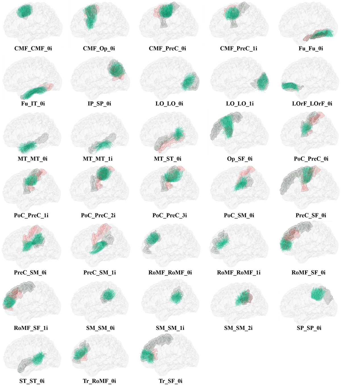 Frontiers Clustering Of Whole Brain White Matter Short