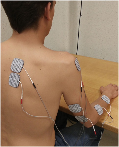 Later anterior deltoid head Electrode Placement for Compex Muscle