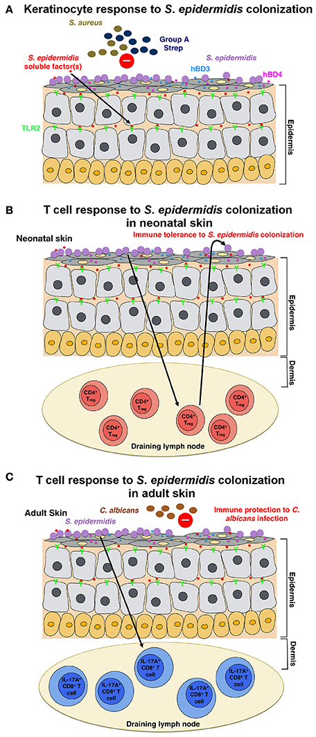 staphylococcus epidermis epidermidi