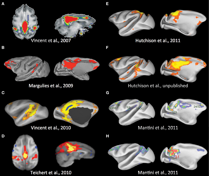 Frontiers Monkey In The Middle Why Non Human Primates Are Needed To Bridge The Gap In Resting State Investigations Frontiers In Neuroanatomy