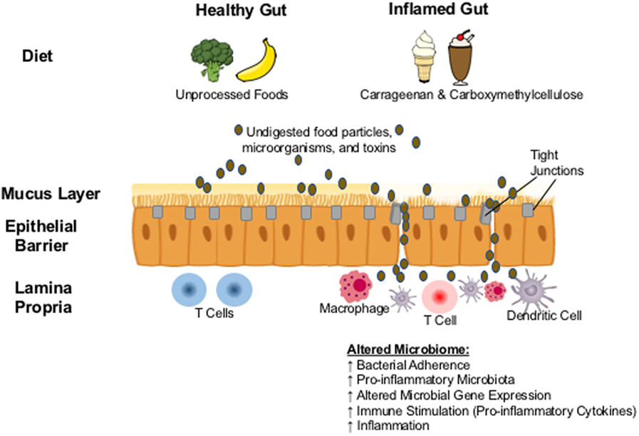 Frontiers  The Role of Carrageenan and Carboxymethylcellulose in the  Development of Intestinal Inflammation