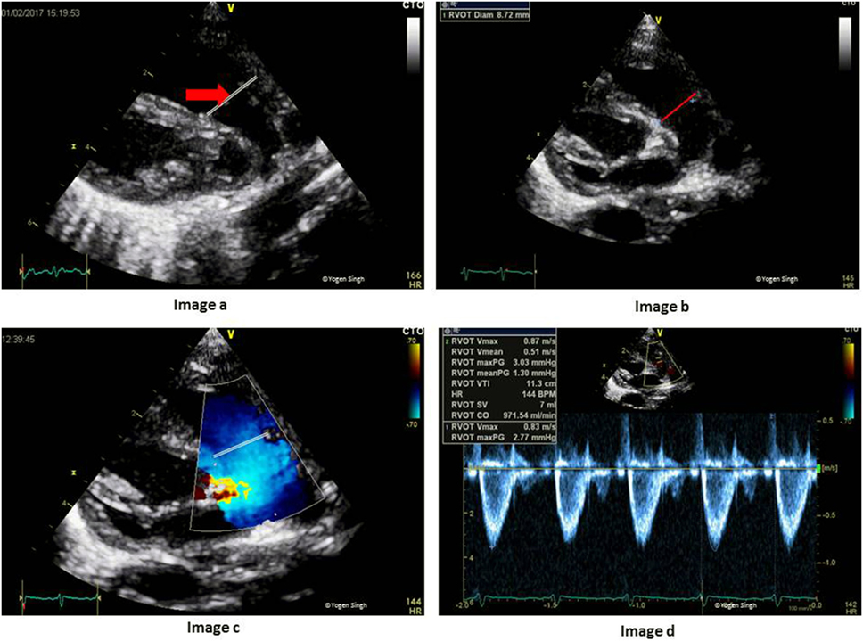 Frontiers  Hemodynamic and Metabolic Assessment of Neonates With