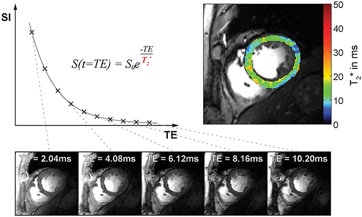 T2 Relaxation Times at Cardiac MRI in Healthy Adults: A Systematic